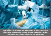 آیا می‌توان تعویض مفصل زانو را به‌صورت سرپایی انجام داد؟